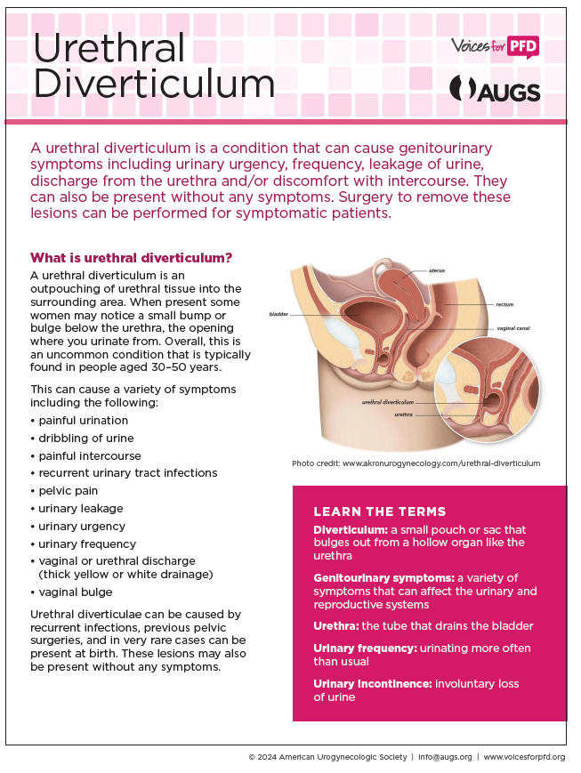 Urethral_Diverticulum