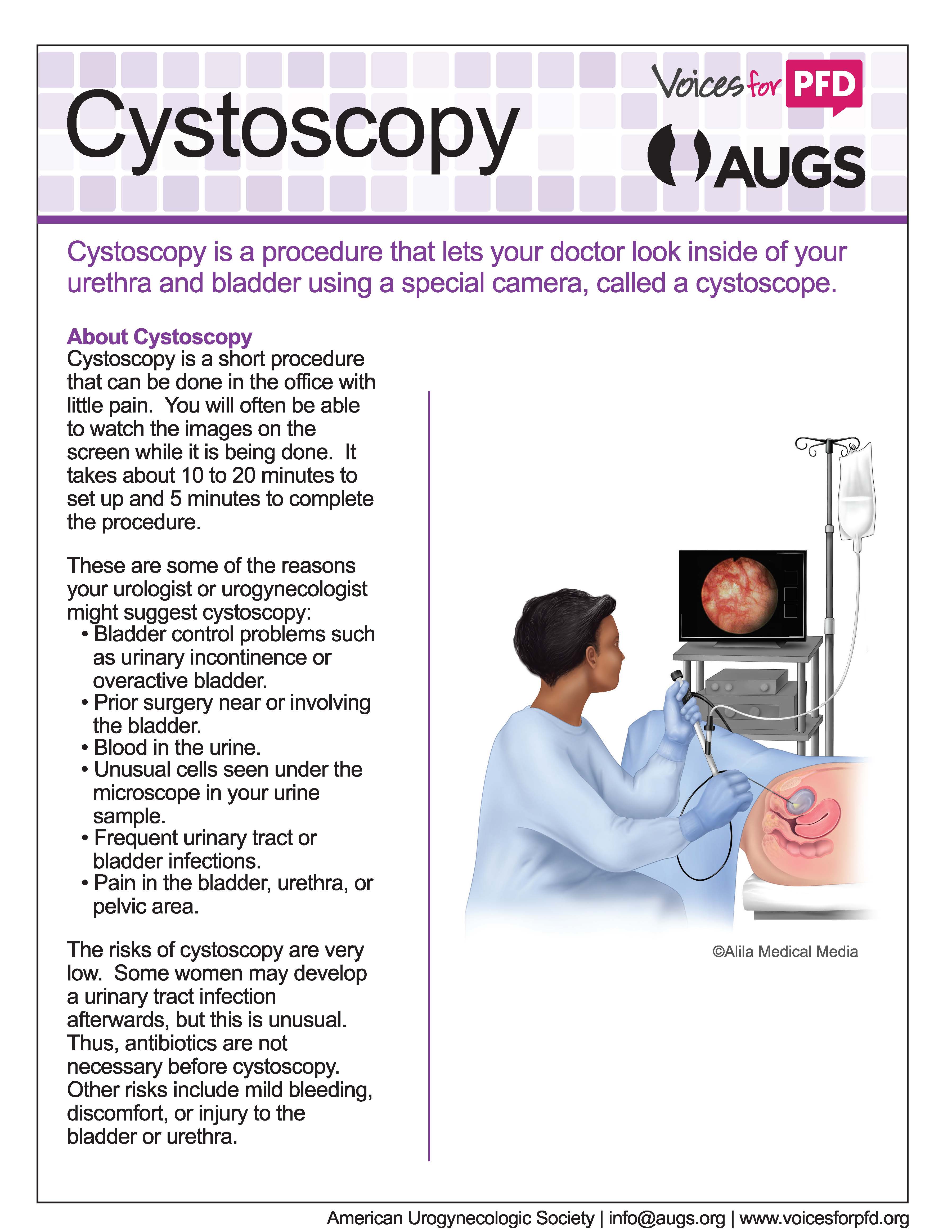 https://www.voicesforpfd.org/assets/2/6/Cystoscopy_Large_Print_Page_1.jpg