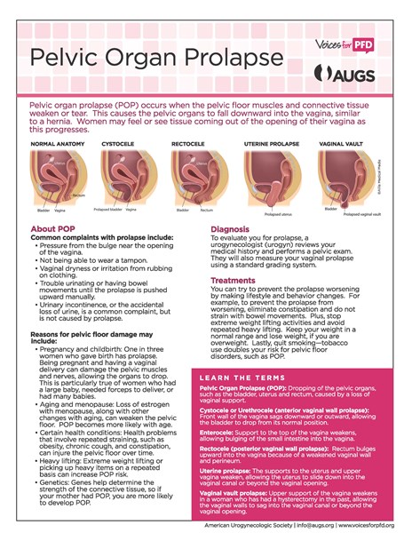 Pelvic Organ Prolapse Patient Education Poster — APOPS